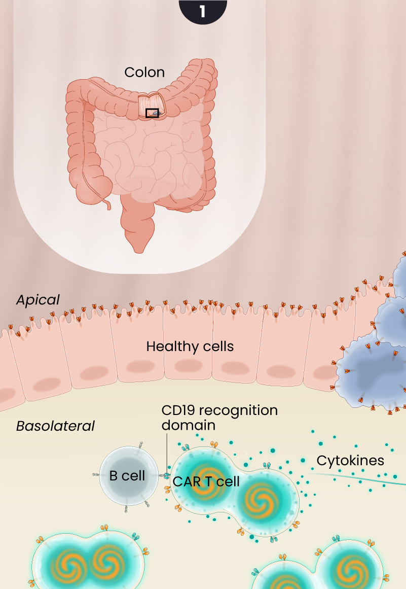 Illustration of the proposed mechanism of action of LYL273 CAR T cells against colorectal cancer. An inset of the tumor location in the transverse colon and a cross-section of the colon’s cellular environment. The CAR T cells recognize the CD19 receptor on B cells on the basolateral side of the colon. The CAR T cells actively replicate, and begin releasing cytokines.