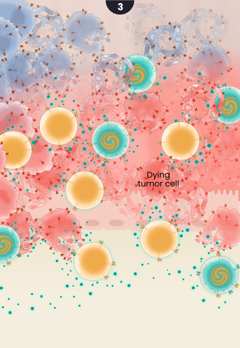 Illustration of the proposed mechanism of action of LYL273 CAR T cells against colorectal cancer. CAR T cells continue to infiltrate the tumor and kill the tumor cells while leaving healthy cells untouched.