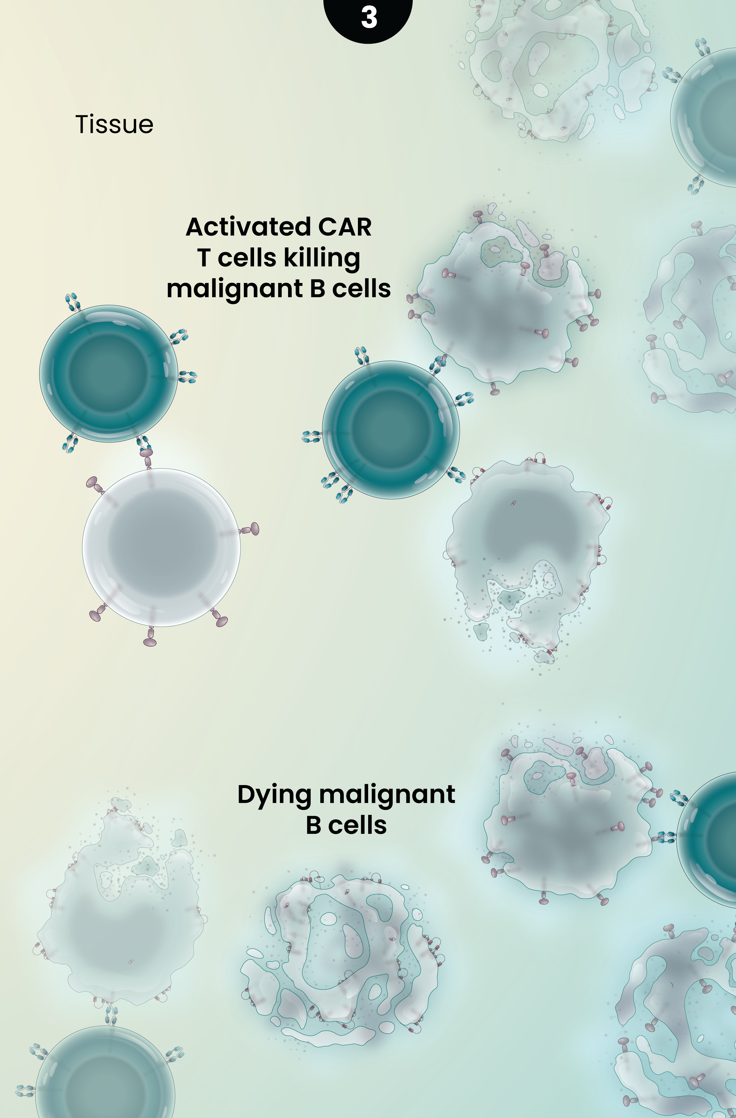 Illustration of the proposed mechanism of action of Ronde-cel CAR T cells against hematologic malignancies. The dual-targeting CAR T cells bind to and subsequently kill malignant B cells.
